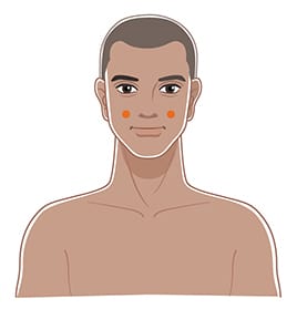 acupression st3 Estomac 3 (ST3) ou beauté du visage