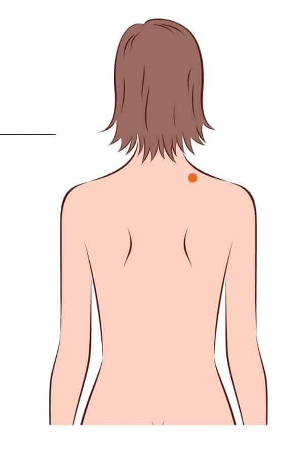 Vésicule biliaire 21 (GB21)