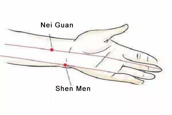 Emplacement du point d'acupuncture Shen men
