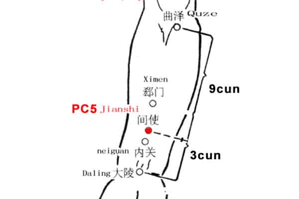 Emplacement du point Jian Shi 5PC