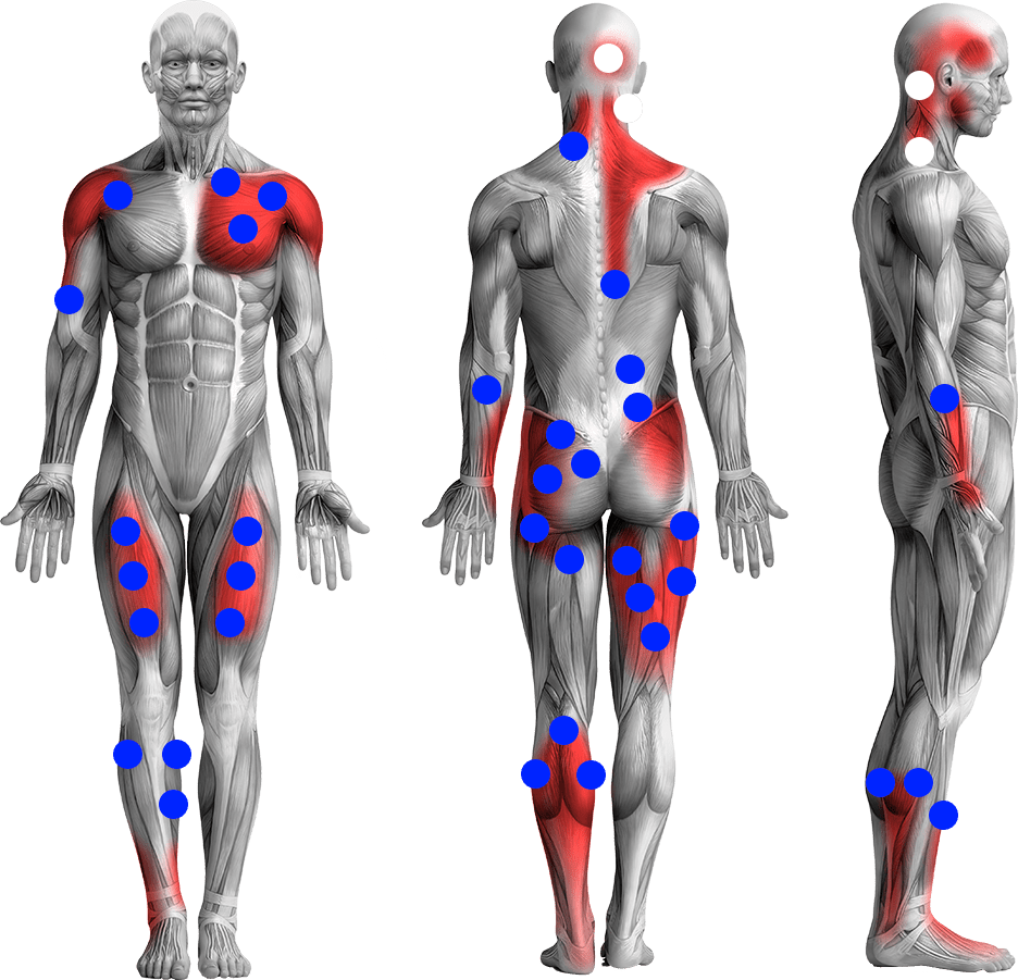 points de déclenchement
