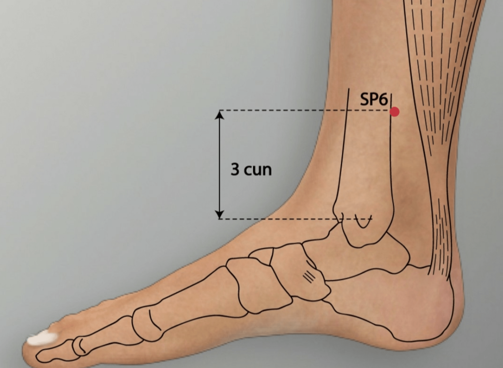 Localisation du point San Yin Jiao (6Rt)