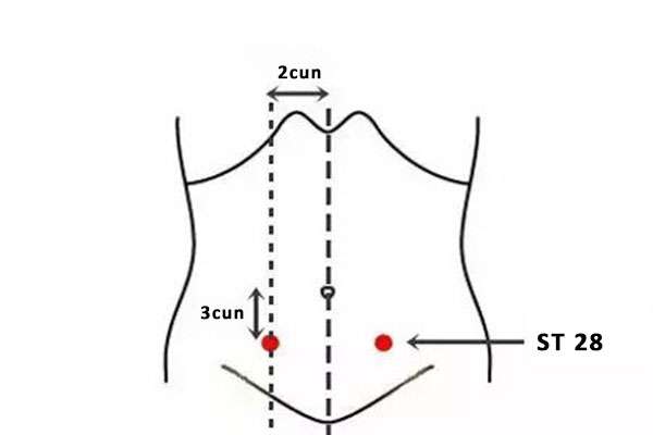 Point d'acupuncture ST 28 (Shuidao)