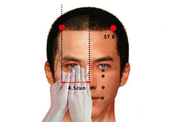 Point d'acupuncture ST 8 (Touwei)