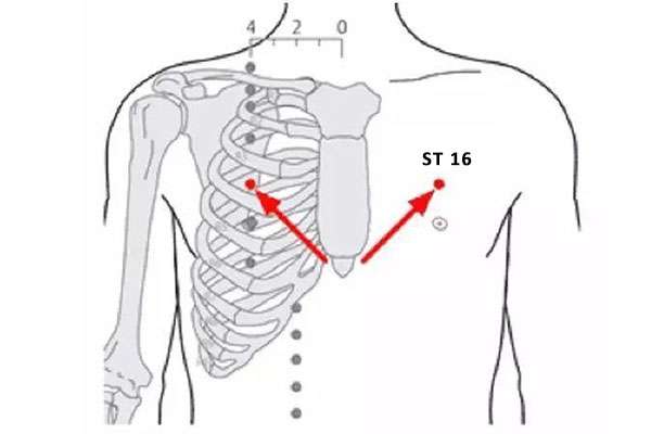 Point d'acupuncture ST 16 (Yingchuang)